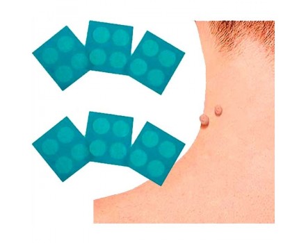 Formuclear Skin Tag Patch 2x1 - Skin tag removal
