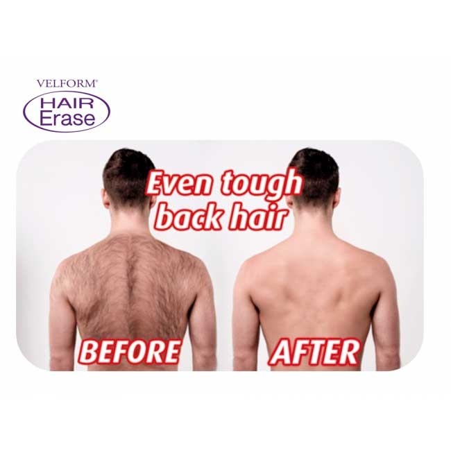 Velform laser depilation precio discount