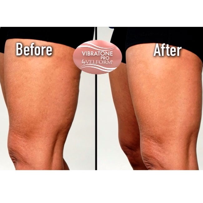 Vibratone Pro Body Toning Device